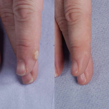 WellaSkin image