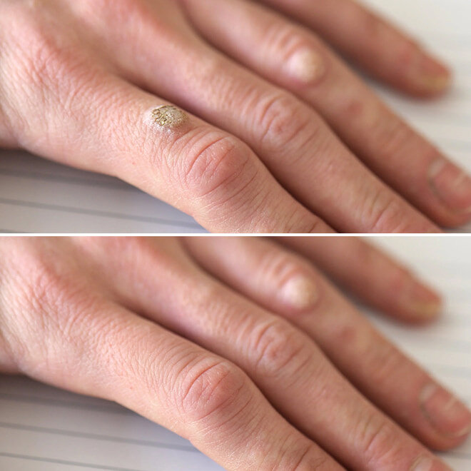 WellaSkin image